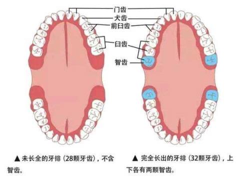 口腔医院拔智齿多少钱(中医讲拔智齿是愚蠢的行为)