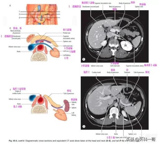 胰腺在人体的哪个部位图解(胰腺在人体的哪个部位图解视频)
