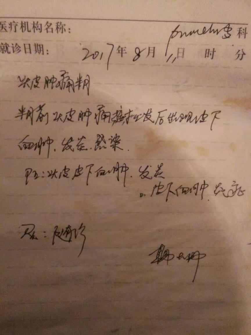 接无痕头发大概多少钱景德镇（羽毛接发后的惨状）